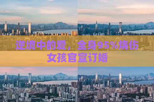 逆境中的爱，全身95%烧伤女孩官宣订婚